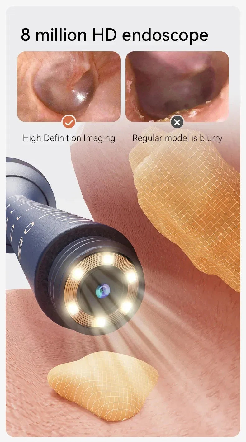Upgraded Smart Visual Ear Wax Cleaner
