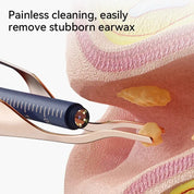 Upgraded Smart Visual Ear Wax Cleaner