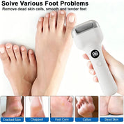 Professional Foot Care Heel Dead Skin Roller