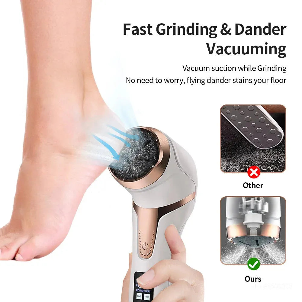 Pedicure Machine Callus Remover Rechargeable Foot Heel