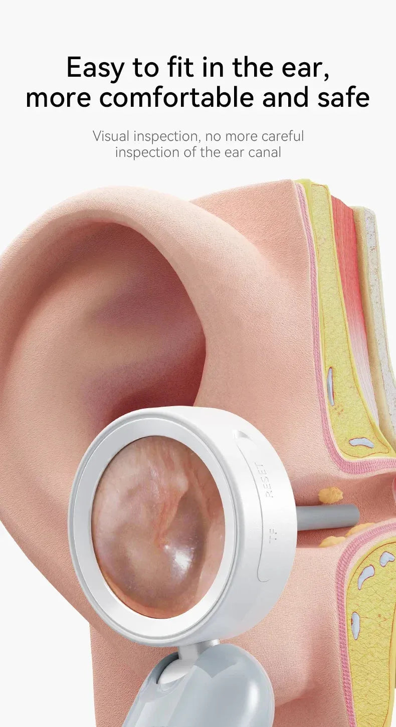 Camera Ear Wax Cleaner Camera for Ears Nose