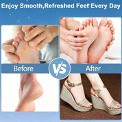 Professional Foot Care Heel Dead Skin Roller