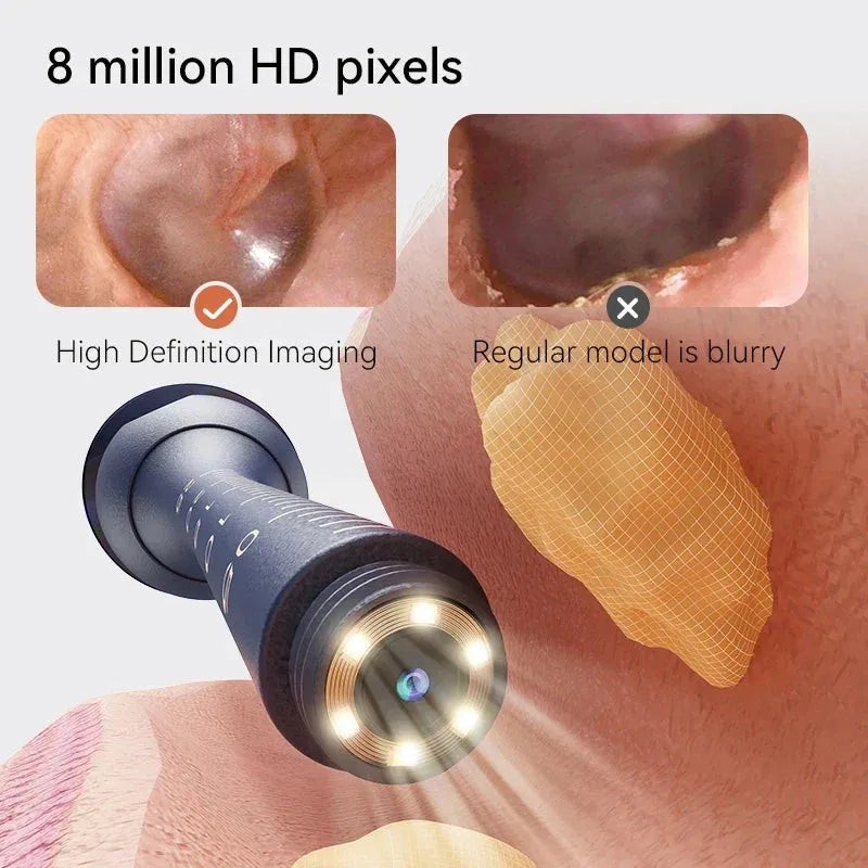 Upgraded Smart Visual Ear Wax Cleaner