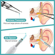 Illustration of earwax removal using tweezers and ear spoon, showing ear anatomy and cleaning tools for ear hygiene