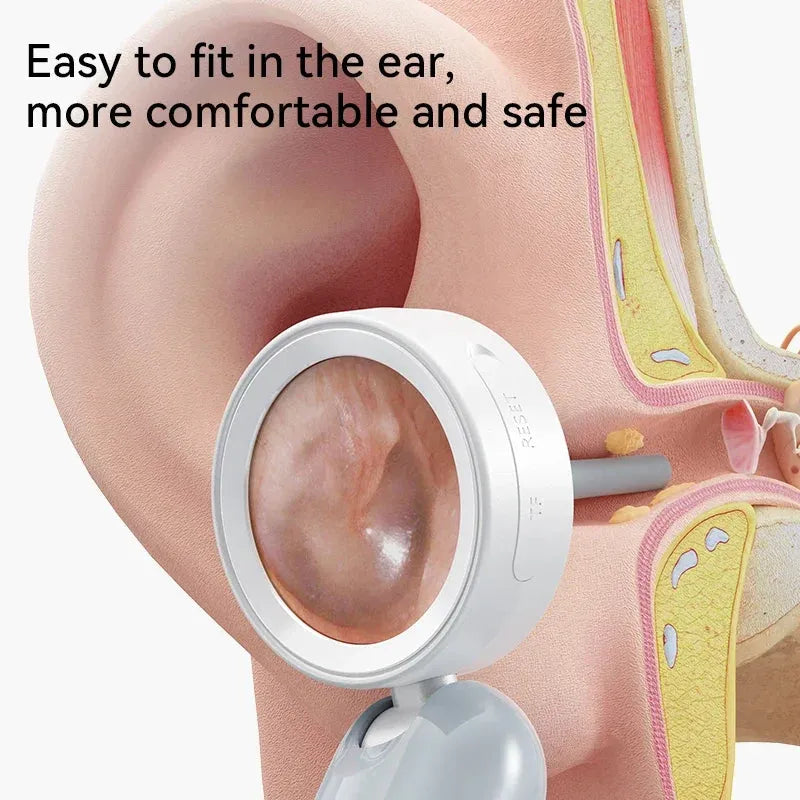Camera Ear Wax Cleaner Camera for Ears Nose