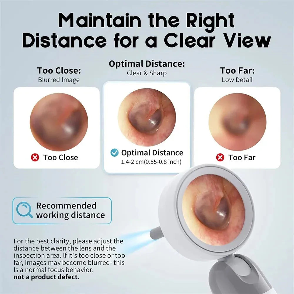 Camera Ear Wax Cleaner Camera for Ears Nose