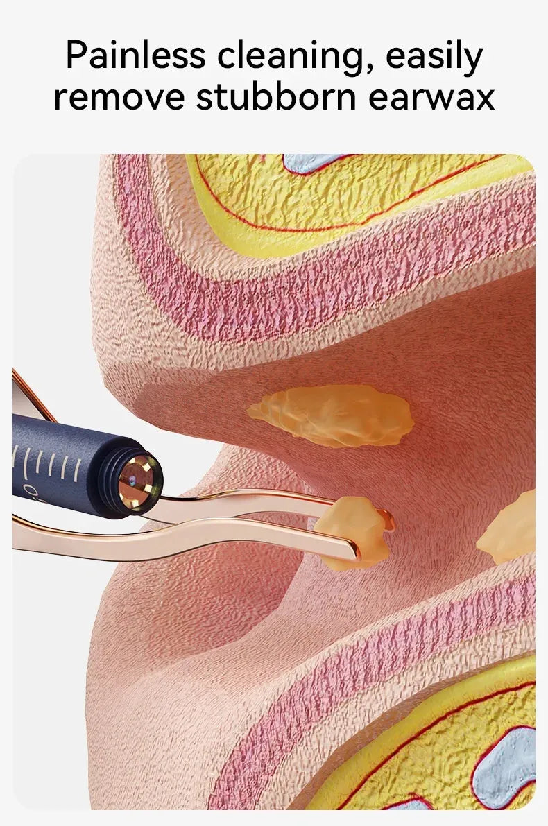 Upgraded Smart Visual Ear Wax Cleaner