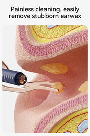 Upgraded Smart Visual Ear Wax Cleaner